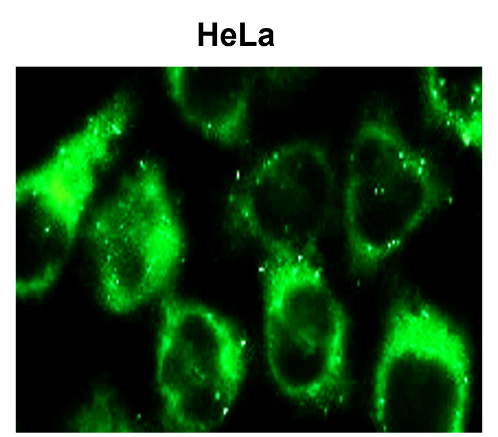 IR91-384 anti-SQSTM1 / p62 antibody ICC image IR91-384 anti-SQSTM1 / p62 antibody ICC image