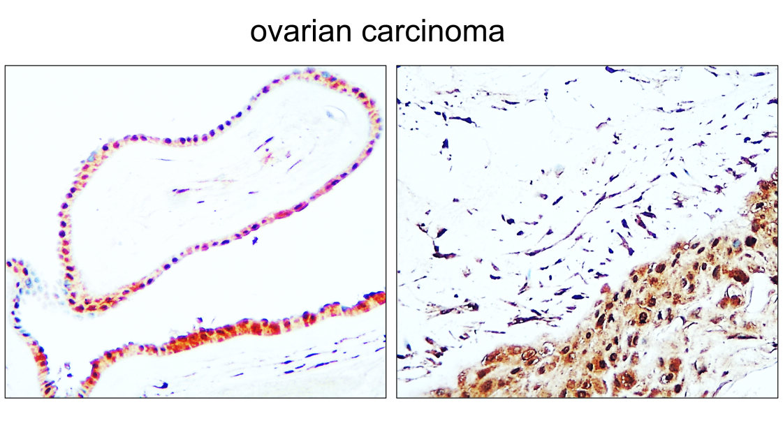 IR344-930 anti-PPARγ antibody IHC image IR344-930 anti-PPARγ antibody IHC image