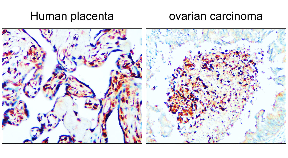 IR344-930 anti-PPARγ antibody IHC image IR344-930 anti-PPARγ antibody IHC image