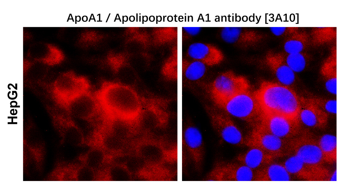 IRM206 ApoA1 / Apolipoprotein A1 antibody [3A10]  ICC image