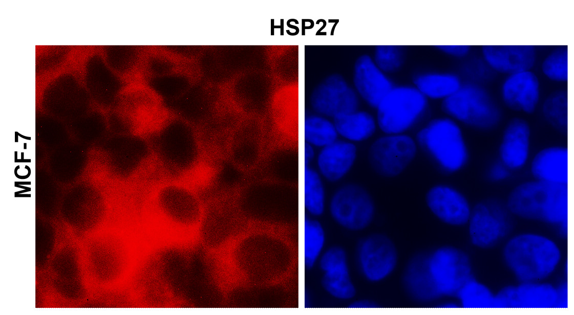IRM208 HSP27 antibody [6D9] ICC/IF image