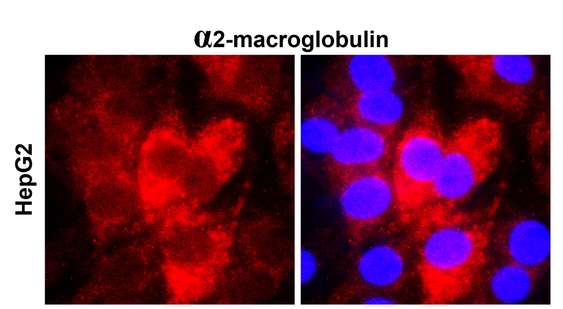 IRM204 alpha 2-macroglobulin antibody [15A04-1G3] ICC/IF image