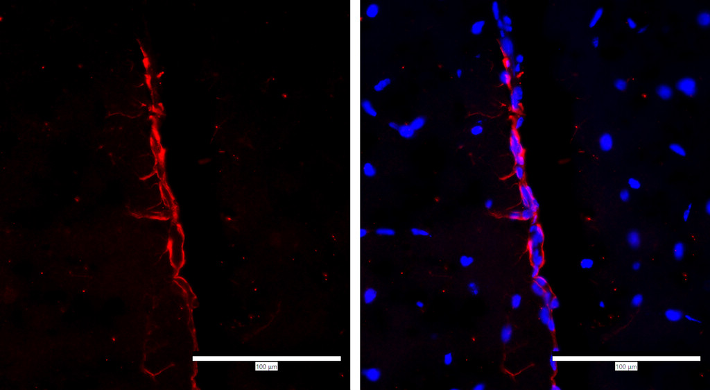 IR11-26 anti-SOX2 antibody IHC image IR11-26 anti-SOX2 antibody IHC image