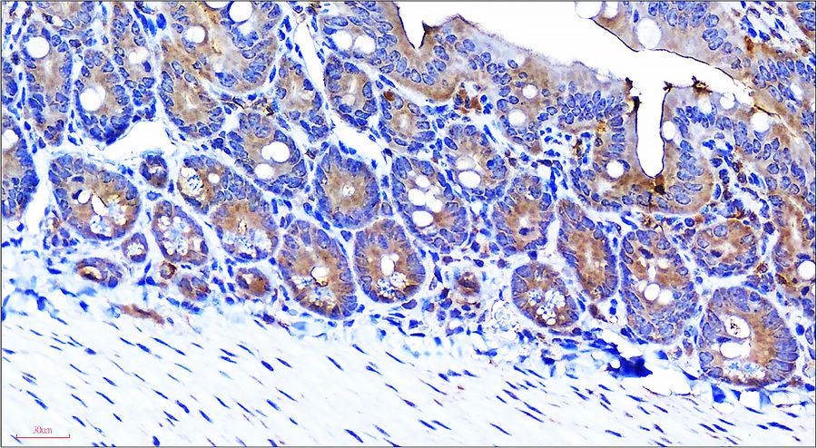 IR108-442 anti-VEGF antibody IHC image VEGF antibody IR108-442 anti-VEGF antibody IHC image VEGF antibody