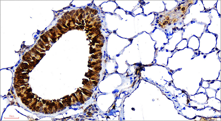 IR108-442 anti-VEGF antibody IHC image VEGF antibody IR108-442 anti-VEGF antibody IHC image VEGF antibody