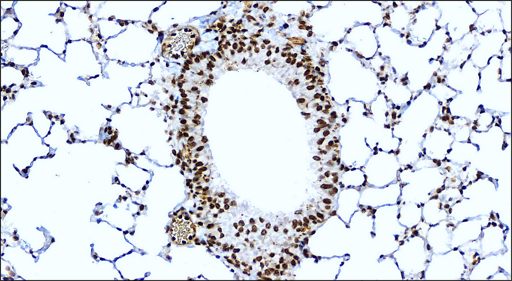 IR136-543 anti-NRF2 antibody IHC image IR136-543 anti-NRF2 antibody IHC image