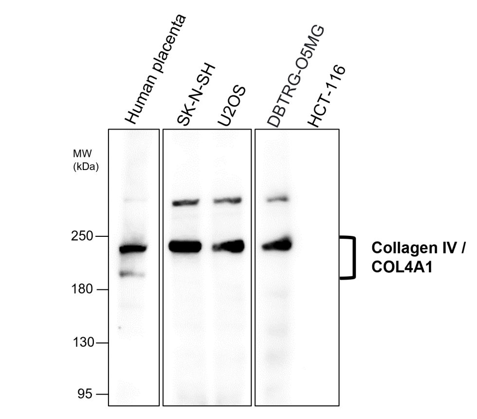 IR298-1 anti-COL4A1 / Collagen IV antibody WB image