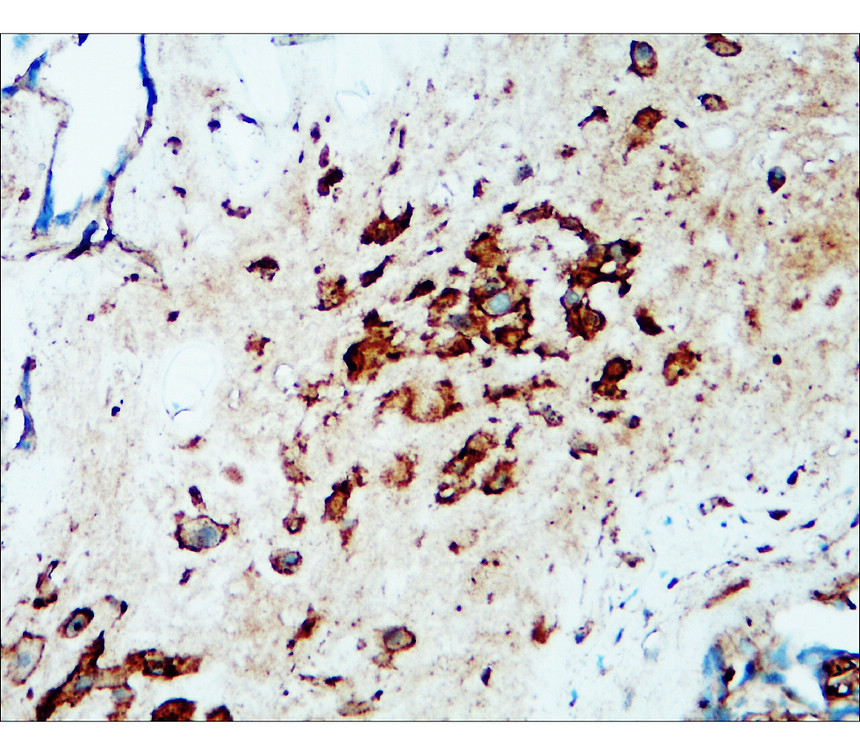 IR304-990 Flotillin-1 antibody_Human placenta IHC image