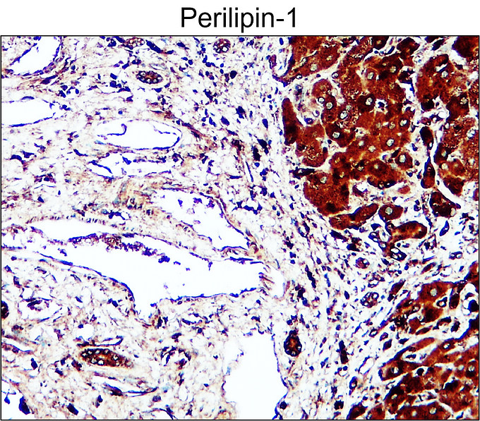 IR343-927 anti-Perilipin-1 antibody IHC image IR343-927 anti-Perilipin-1 antibody IHC image