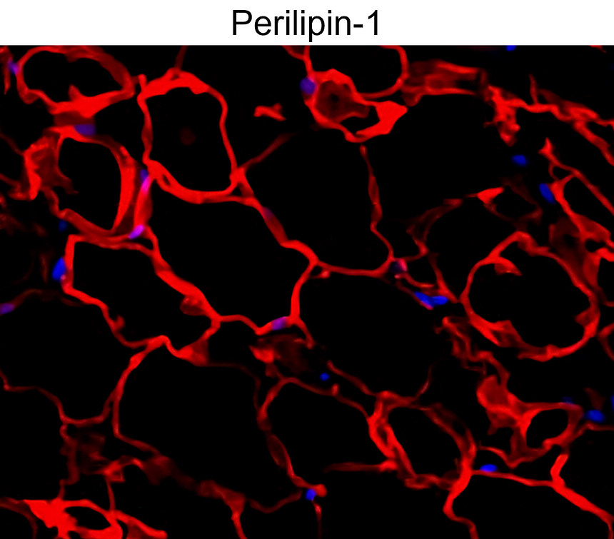 IR343-927 anti-Perilipin-1 antibody IF image IR343-927 anti-Perilipin-1 antibody IF image