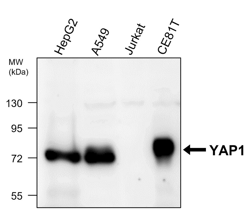 IR290-956 anti-YAP1 antibody WB image IR290-956 anti-YAP1 antibody WB image