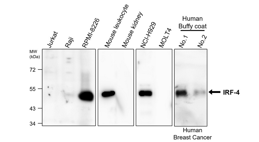 IR291-959 anti IRF-4 / MUM1 antibody WB image IR291-959 anti IRF-4 / MUM1 antibody WB image