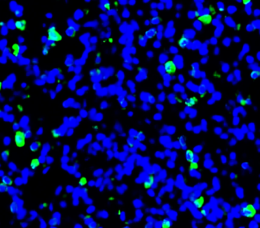 IR240-864 anti-CD206 / MRC1 / Mannose Receptor antibody IHC image