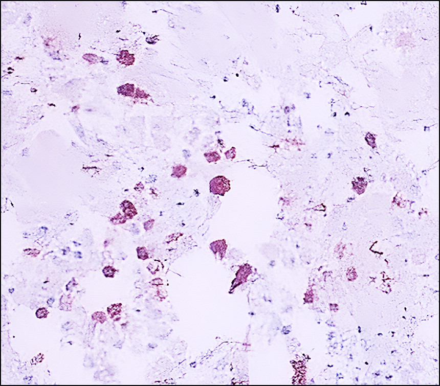 IR240-864 anti-CD206 / MRC1 / Mannose Receptor antibody IHC image IR240-864 anti-CD206 / MRC1 / Mannose Receptor antibody IHC image