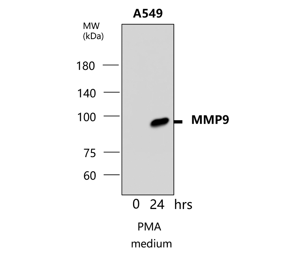 IR70-234 anti-MMP9 antibody WB image IR70-234 anti-MMP9 antibody WB image