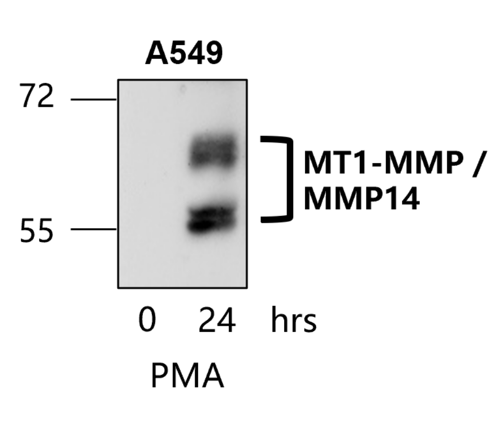 IR71-245 anti-MMP14 / MT1-MMP antibody WB image IR71-245 anti-MMP14 / MT1-MMP antibody WB image