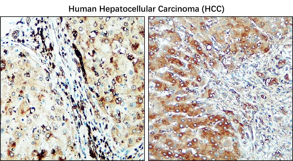 IR240-864 anti-CD206 / MRC1 / Mannose Receptor antibody IHC image IR240-864 anti-CD206 / MRC1 / Mannose Receptor antibody IHC image