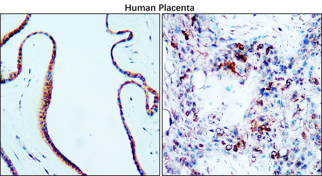 IR79-272 anti-VCAM-1_CD106 antibody ICC_IF image