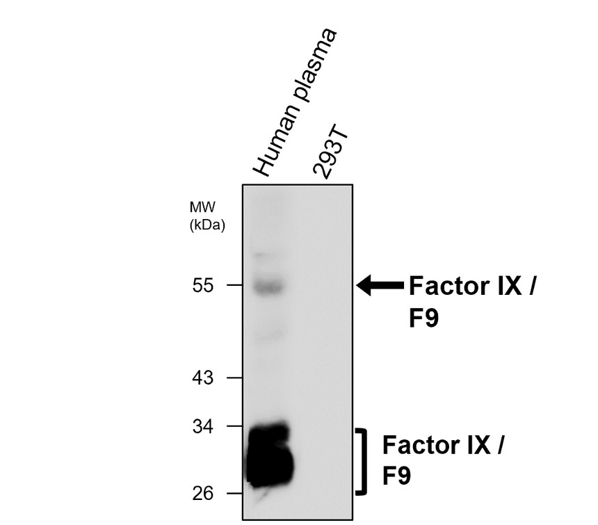 IRM311 Factor IX / F9 antibody [PB-3] WB image 