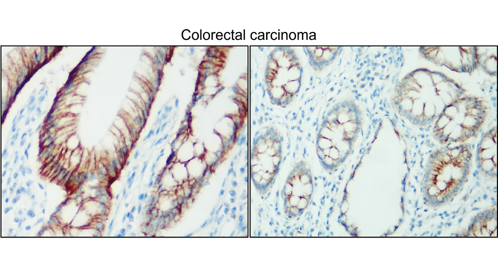 IR24-12 anti-Na/K ATPase antibody IHC image IR24-12 anti-Na/K ATPase antibody IHC image