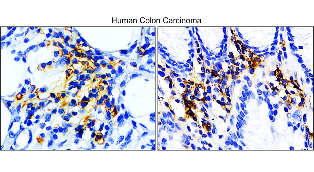 IR167-645 anti-PD-L1 antibody IHC image IR167-645 anti-PD-L1 antibody IHC image