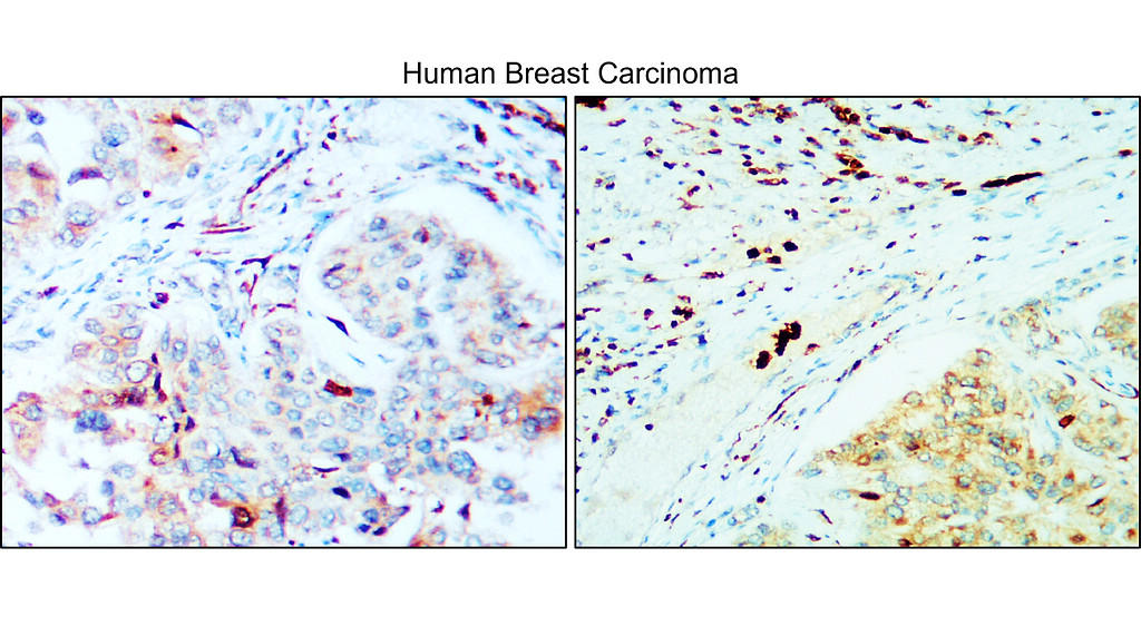 IR167-645 anti-PD-L1 antibody IHC image IR167-645 anti-PD-L1 antibody IHC image