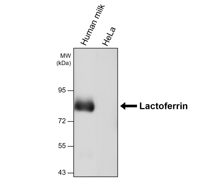 Lactoferrin antibody [521] (IRM215) iReal Biotechnology, Inc.