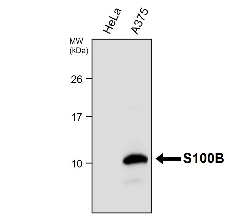 IR27-69 anti-S100B antibody WB image IR27-69 anti-S100B antibody WB image
