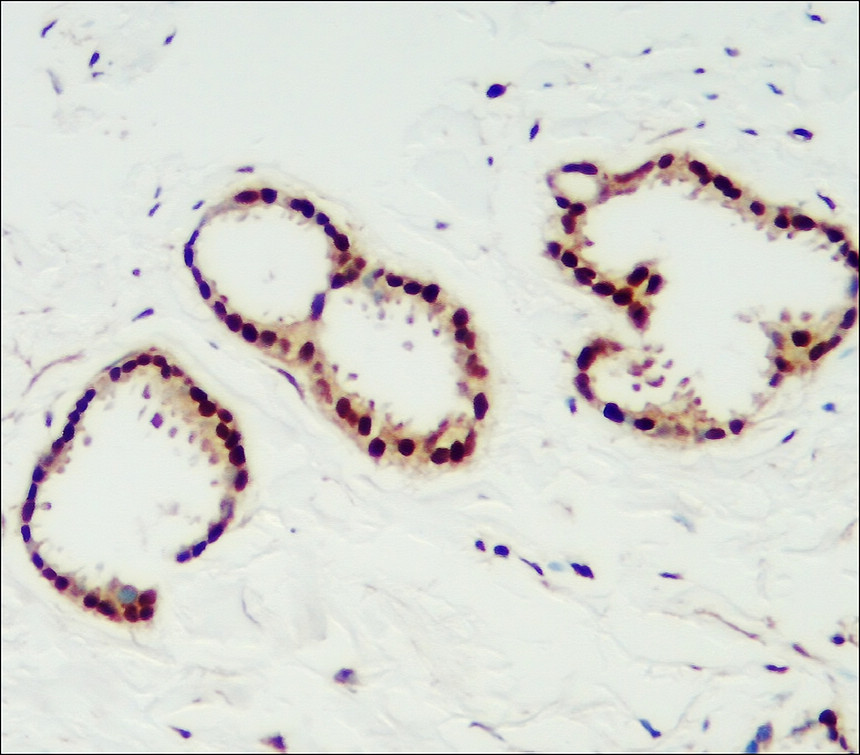 Progesterone Receptor antibody Progesterone Receptor antibody