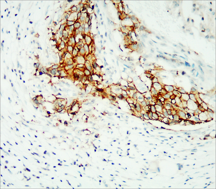 HER2 / ERBB2 antibody HER2 / ERBB2 antibody