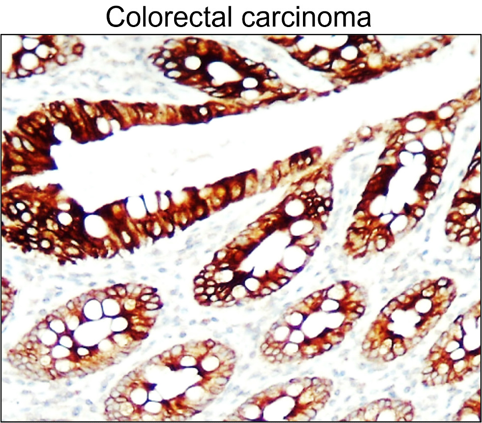 Cytokeratin 7 / CK7 antibody Cytokeratin 7 / CK7 antibody