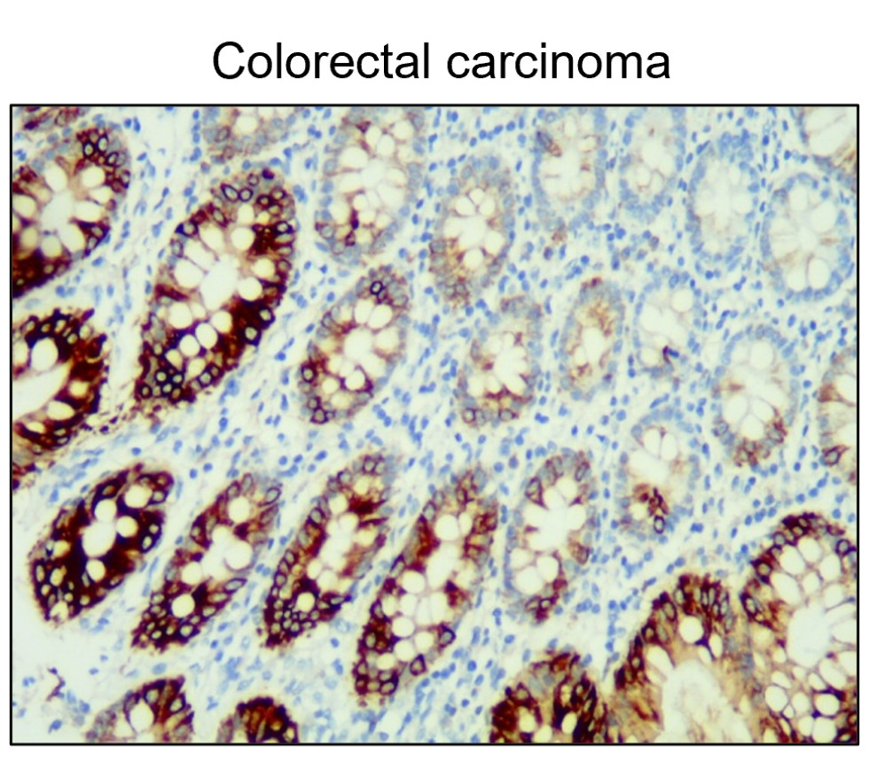Cytokeratin 20 / CK20 antibody Cytokeratin 20 / CK20 antibody