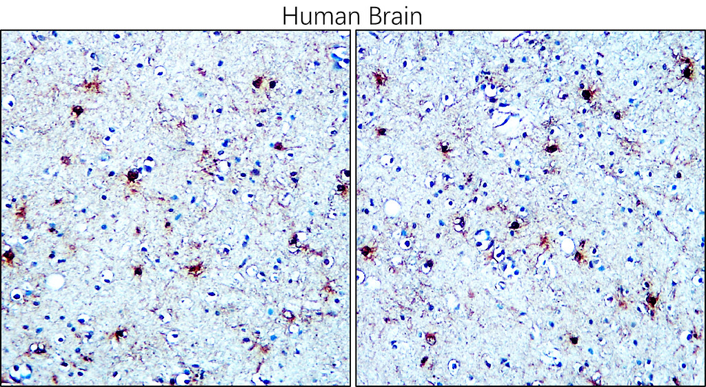 IR27-69 anti-S100B antibody IHC image IR27-69 anti-S100B antibody IHC image