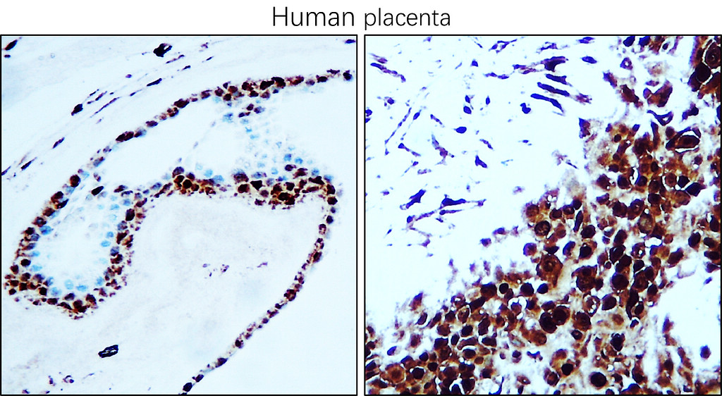 IR357-1 anti-PCNA antibody IHC image IR357-1 anti-PCNA antibody IHC image