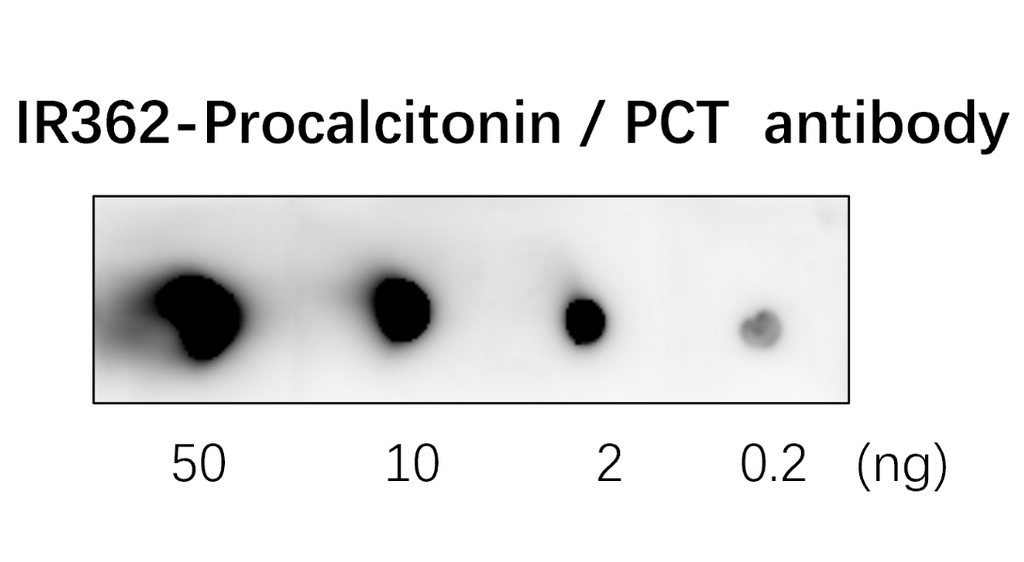 IR362 anti-Procalcitonin / PCT antibody WB image 