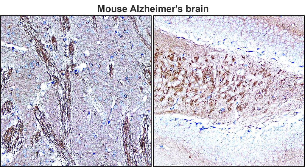 IR39-123 anti-Tau antibody IHC image