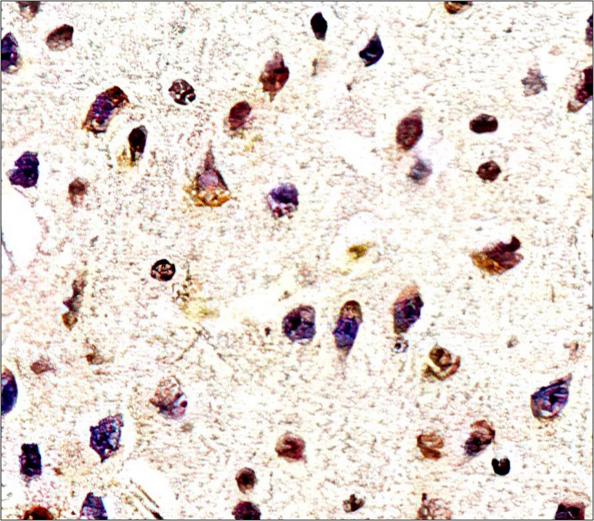 IR39-123 anti-Tau antibody IHC image