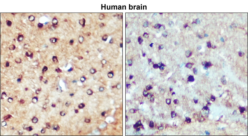 IR39-123 anti-Tau antibody IHC image