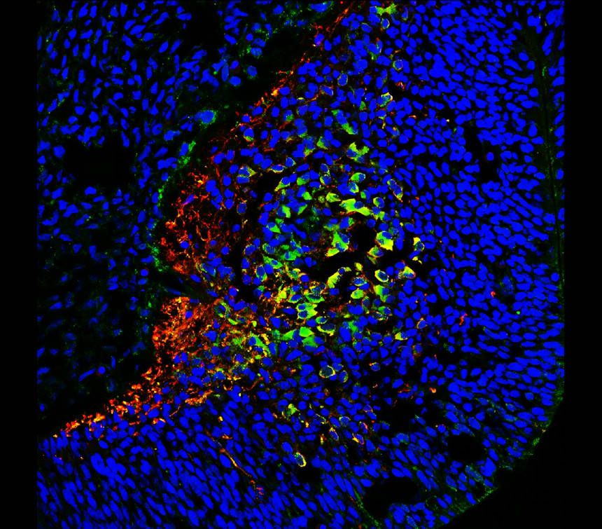 IR39-123 anti-Tau antibody IHC image