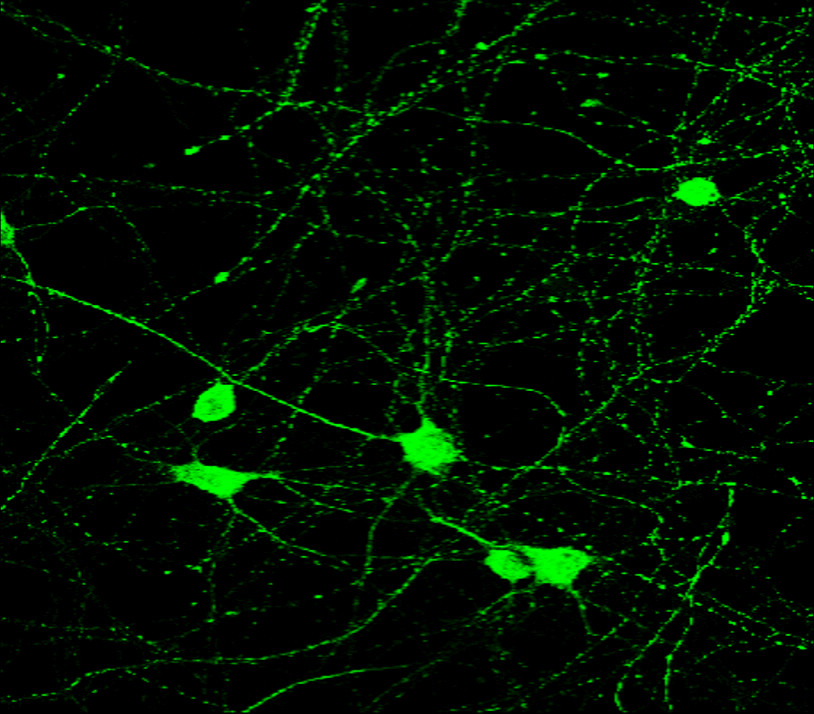 IR39-123 anti-Tau antibody IF image