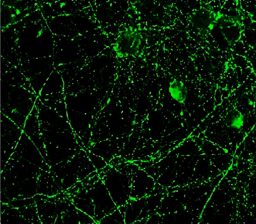 IR39-123 anti-Tau antibody IF image