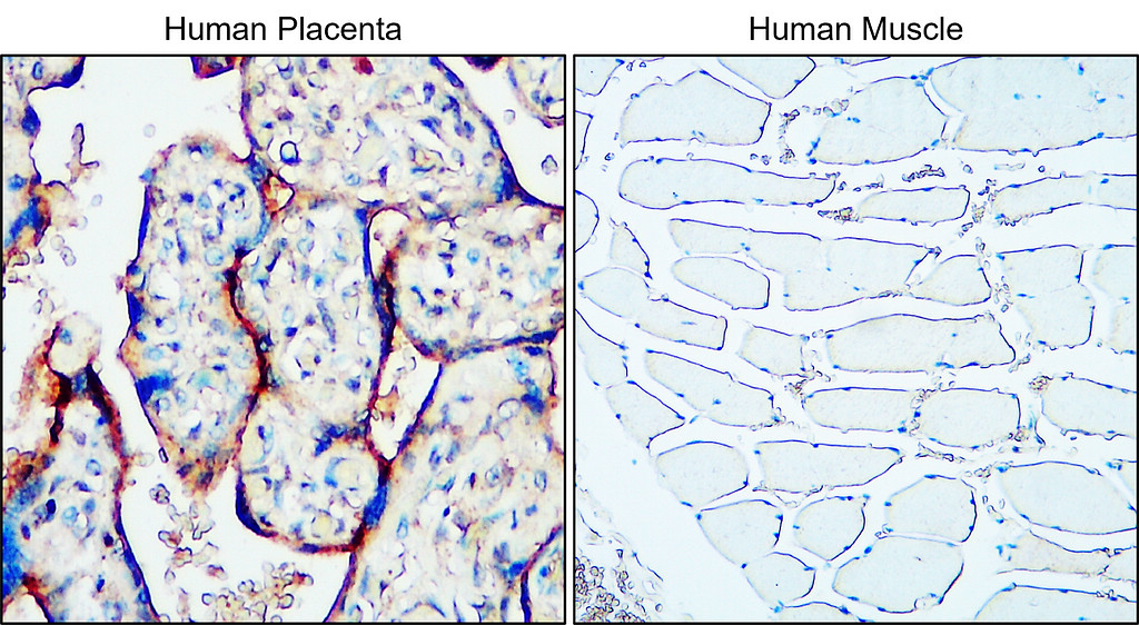 IR221-860 anti-MUC1 antibody IHC image IR221-860 anti-MUC1 antibody IHC image