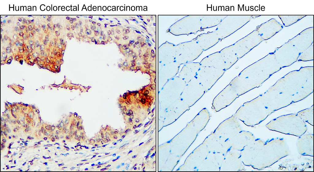 IR221-860 anti-MUC1 antibody IHC image IR221-860 anti-MUC1 antibody IHC image