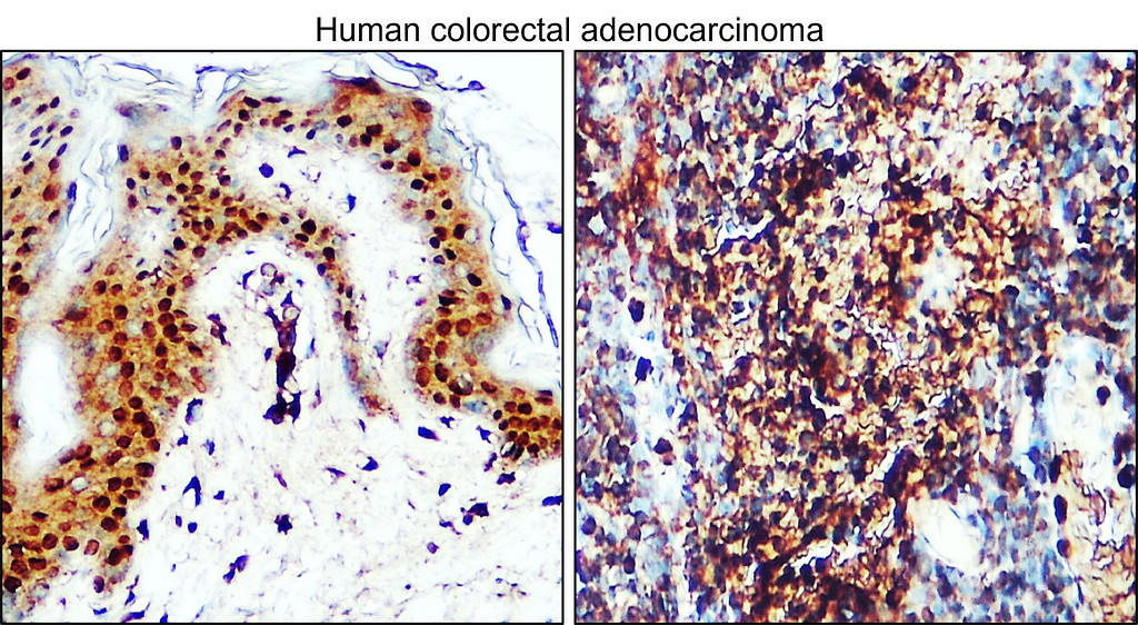 IR351-953 anti-CDX2 antibody IHC image IR351-953 anti-CDX2 antibody IHC image