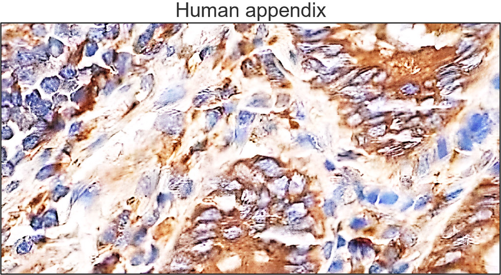 IRM024 NOX2 gp91phox, monoclonal antibody IHC image IRM024 NOX2 gp91phox, monoclonal antibody IHC image