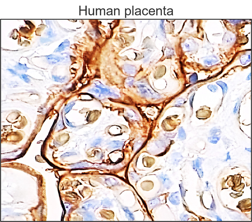 IRM026 GLUT1 Glucose Transporter, monoclonal antibody IHC image IRM026 GLUT1 Glucose Transporter, monoclonal antibody IHC image