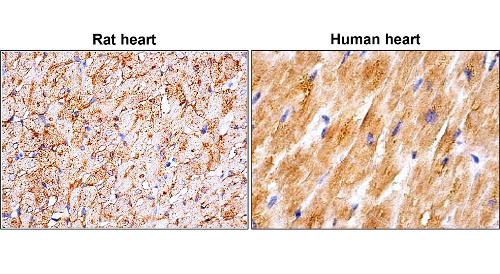 IRM027 GLUT4 Glucose Transporter, monoclonal antibody IHC image IRM027 GLUT4 Glucose Transporter, monoclonal antibody IHC image