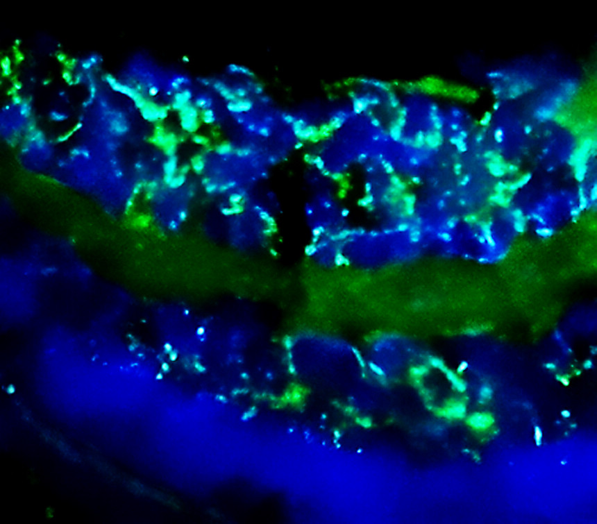 IR31-90 anti-Enolase-2 / ENO2 antibody IHC image IR31-90 anti-Enolase-2 / ENO2 antibody IHC image