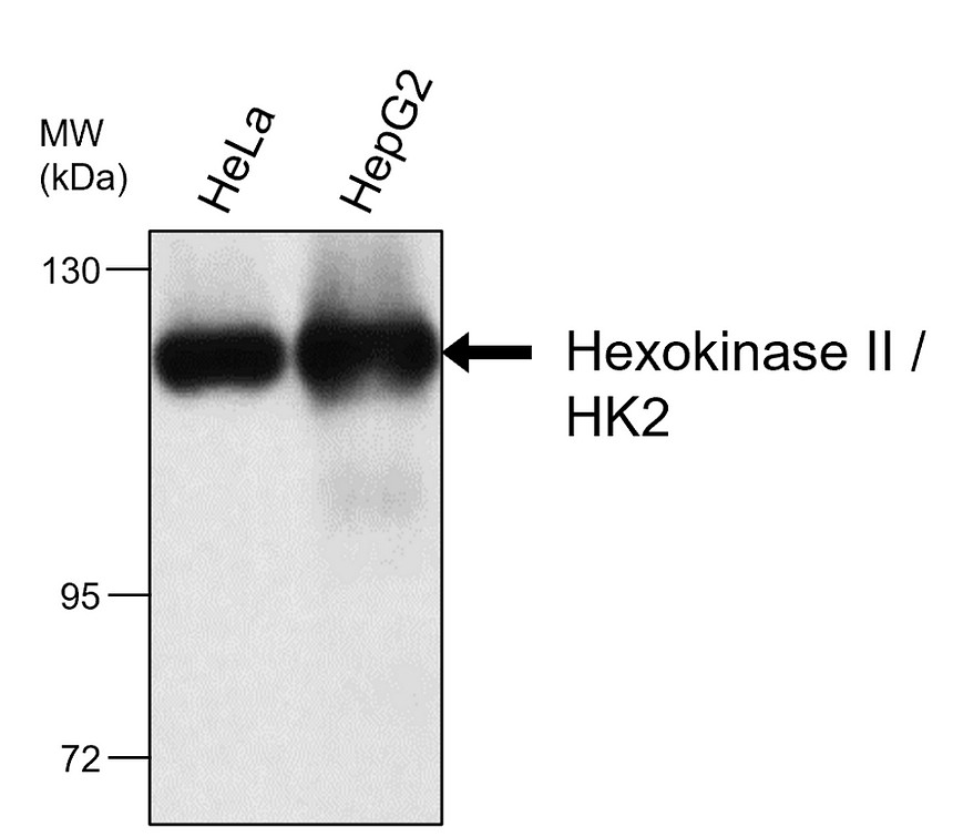 IRM028 Hexokinase II / HK2, monoclonal antibody WB image IRM028 Hexokinase II / HK2, monoclonal antibody WB image