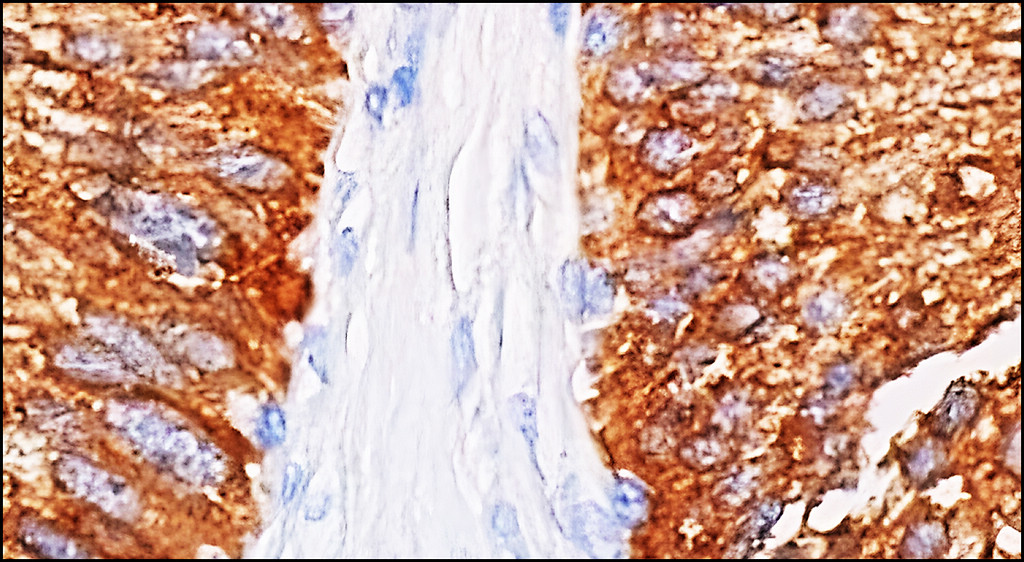 IRM028 Hexokinase II / HK2, monoclonal antibody IHC image IRM028 Hexokinase II / HK2, monoclonal antibody IHC image